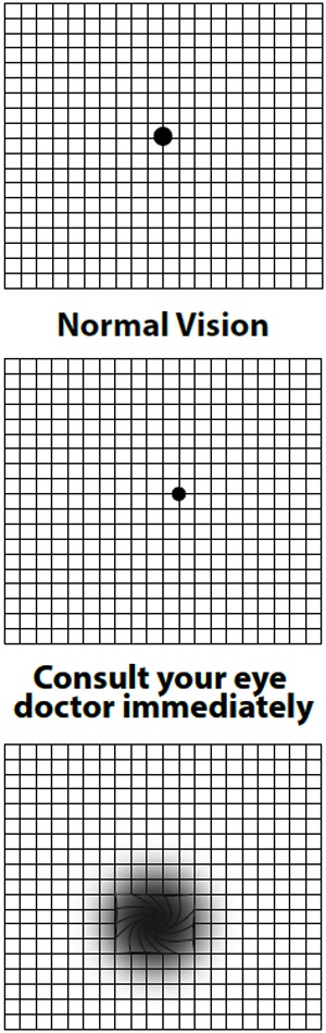 Amsler Grid Test for Retinal Conditions, When to See a Doctor